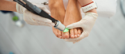 Podiatric Laser as an Ally in the Fight against Athlete&rsquo;s Foot and Nail Fungus