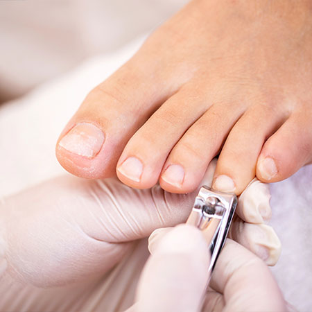 Corte T&eacute;cnico das Unhas