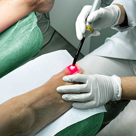 Laser Podológico